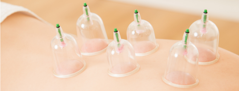 Cupping